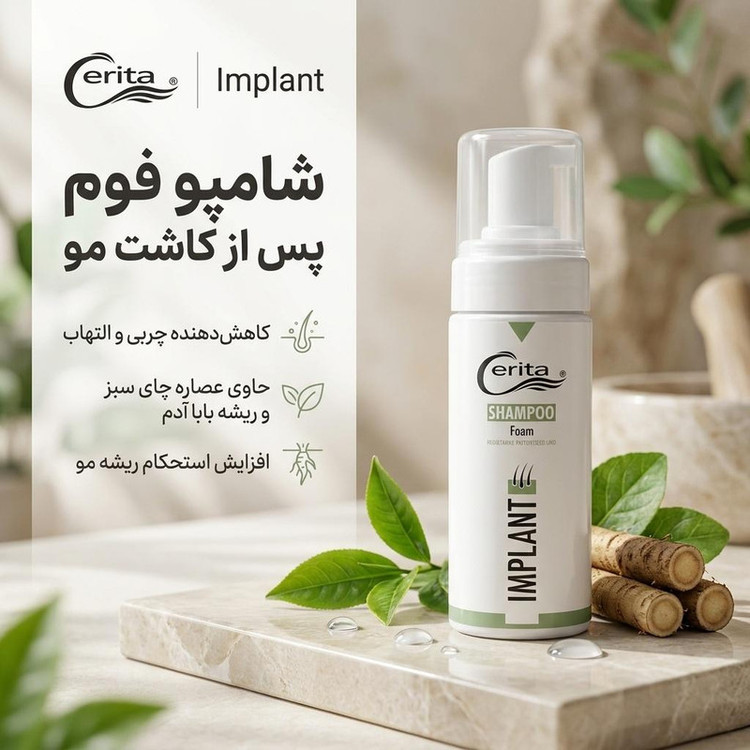 شامپو فوم پس از کاشت مو سریتا مدل Implant حجم 150 میلیلیتر، کاهشدهنده چربی، حاوی عصاره چای سبز و ریشه بابا آدم، افزایش استحکام ریشه مو و رفع التهاب پوست سر