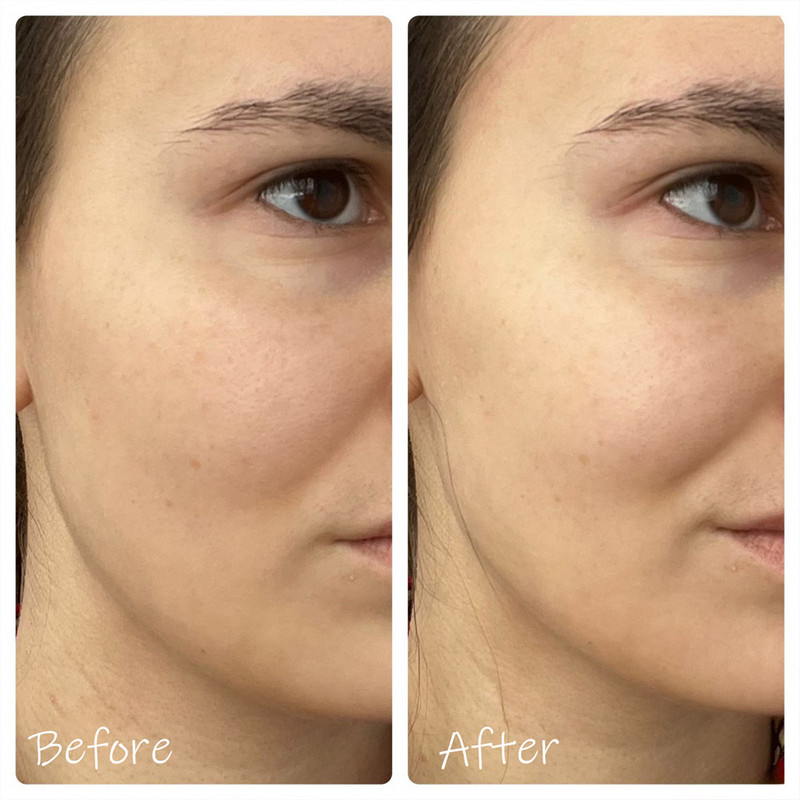 تونر سنتلا مدل HYALU-CICA Brightening حجم 210 میلی لیتر